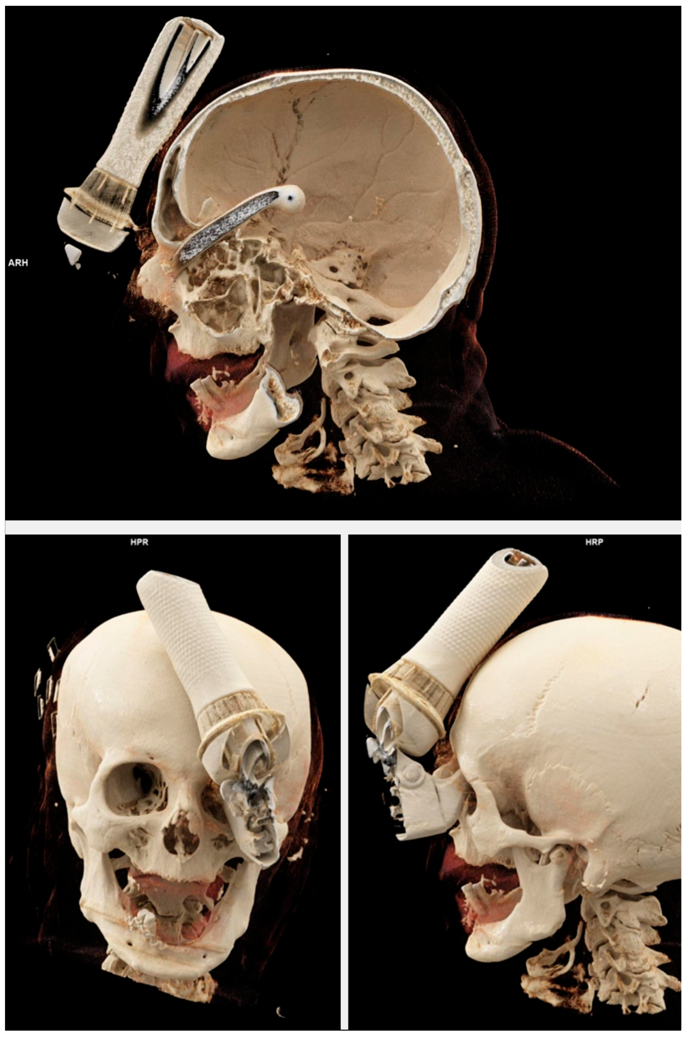 Brainsci 15 01160 g002 Brainsci 15 01160 g002