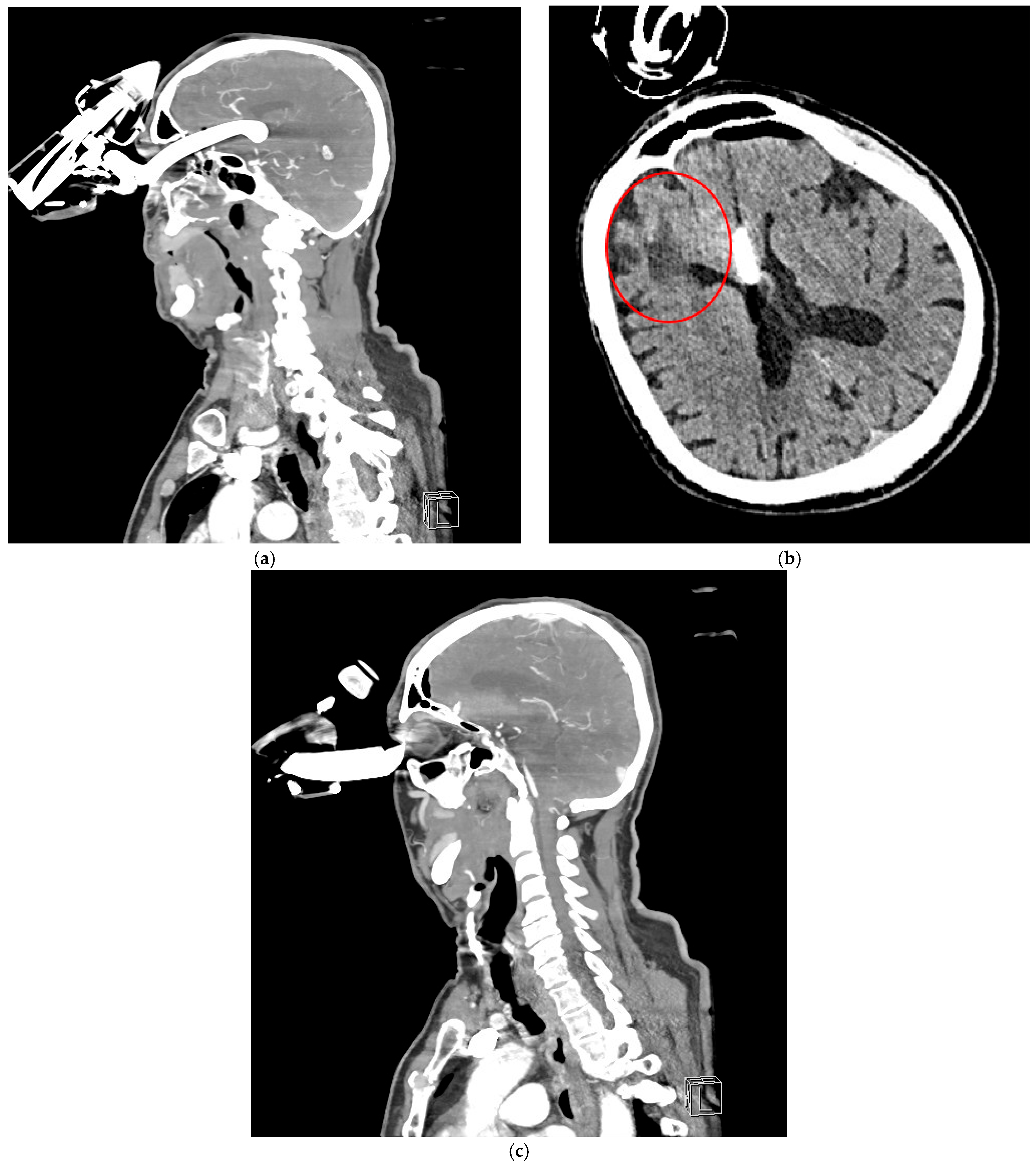 Brainsci 15 01160 g003 Brainsci 15 01160 g003