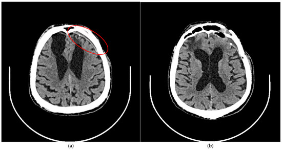 Brainsci 15 01160 g004