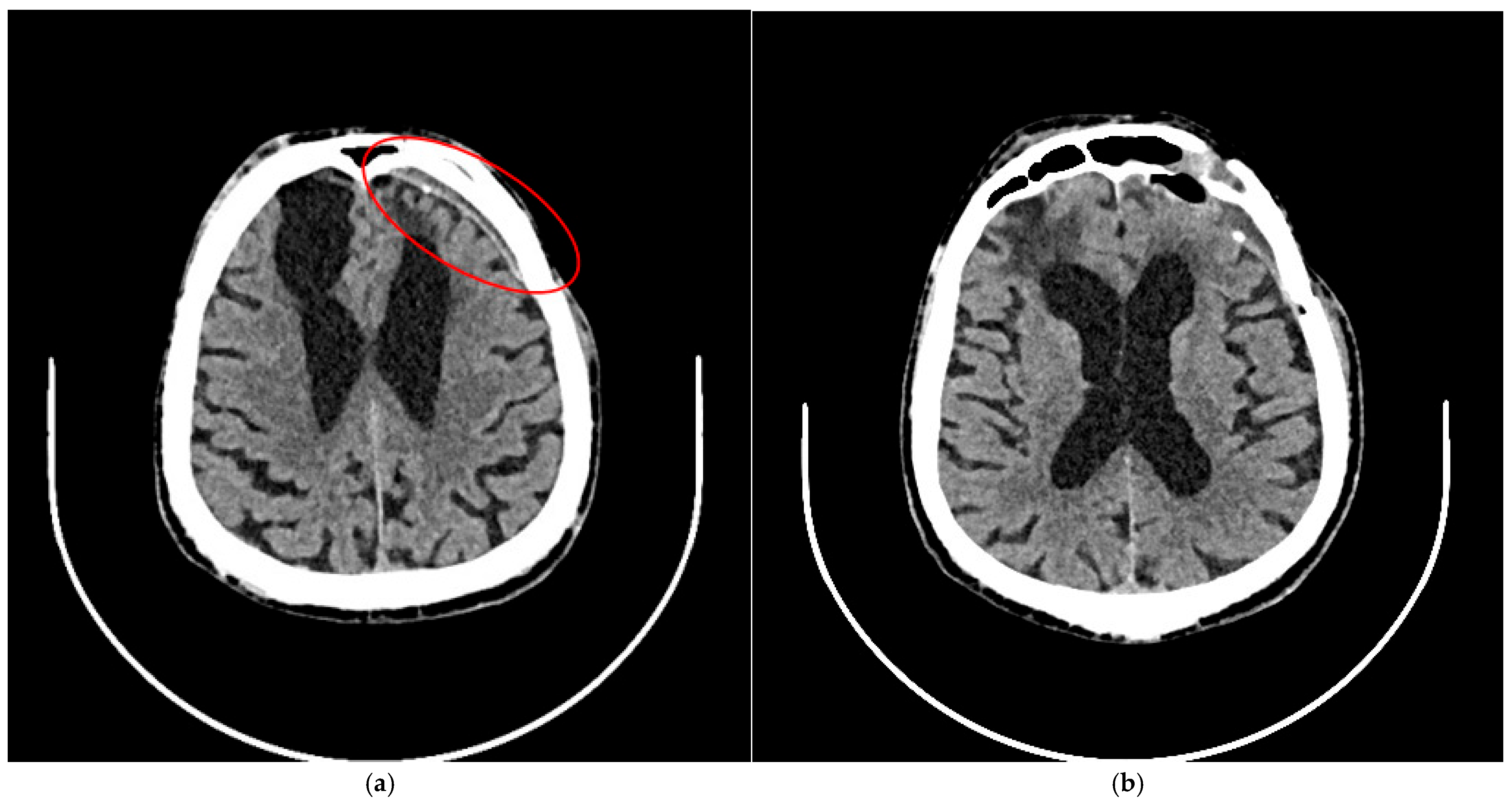 Brainsci 15 01160 g004 Brainsci 15 01160 g004