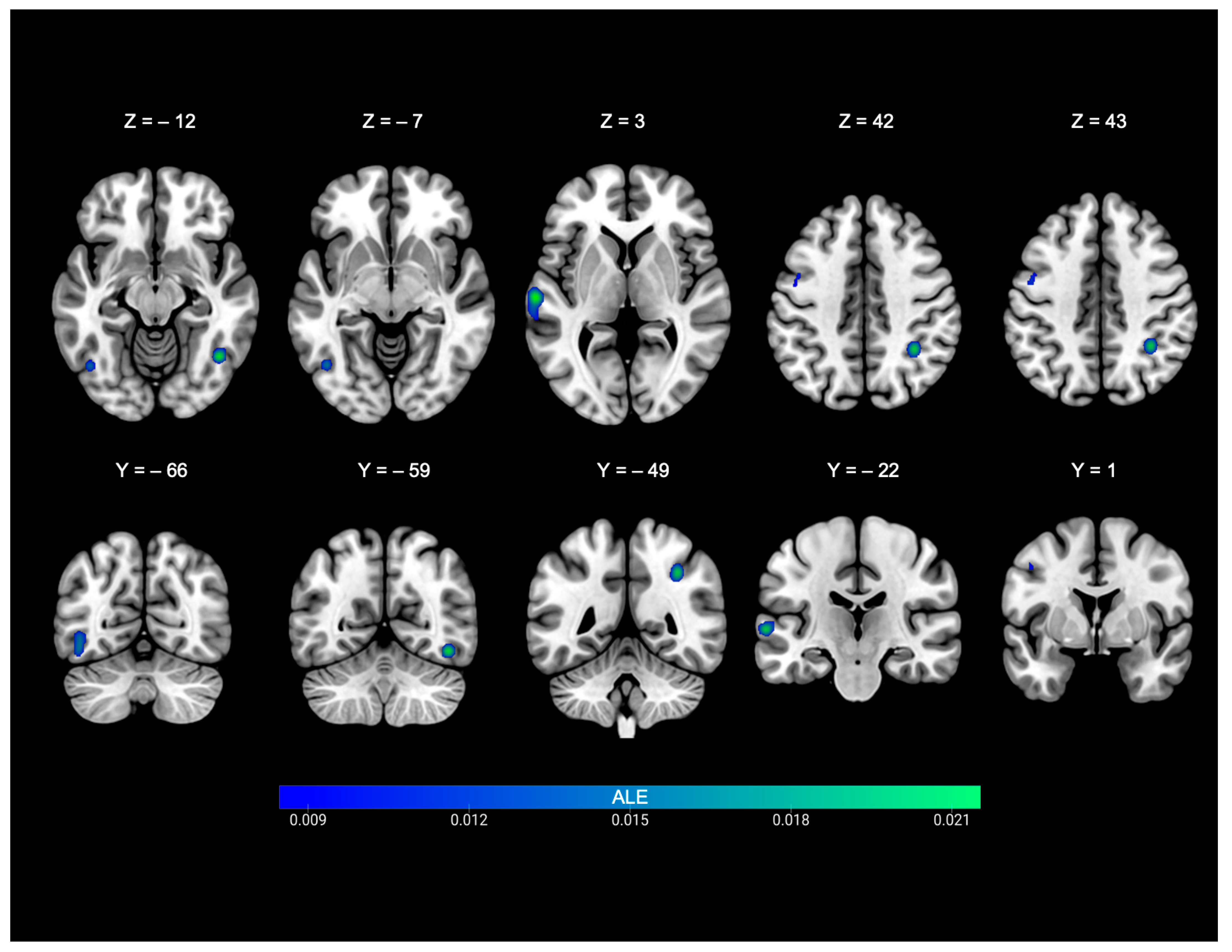 Brainsci 15 01299 g003