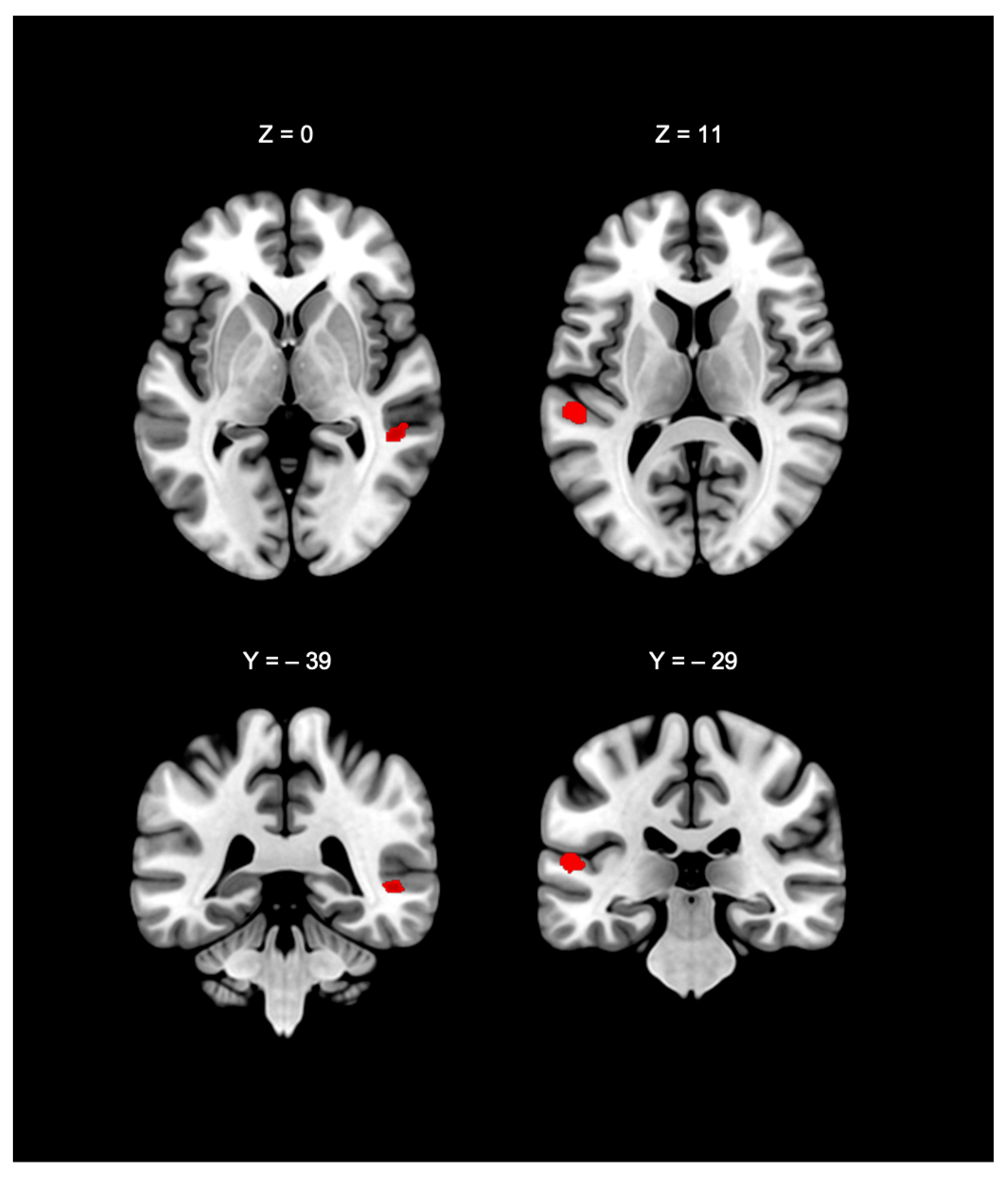 Brainsci 15 01299 g004