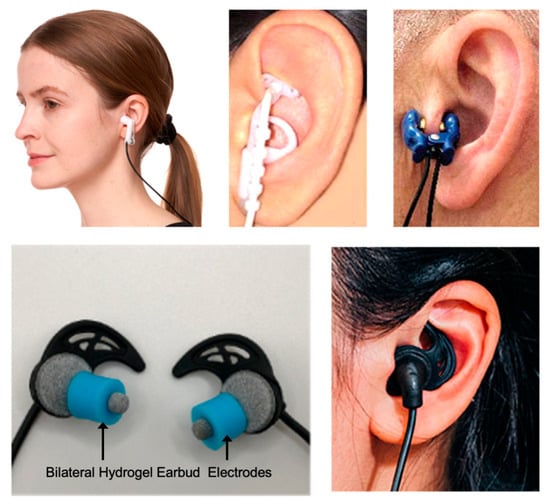 Transcutaneous Auricular Vagus Nerve Stimulation for Treating Emotional ...