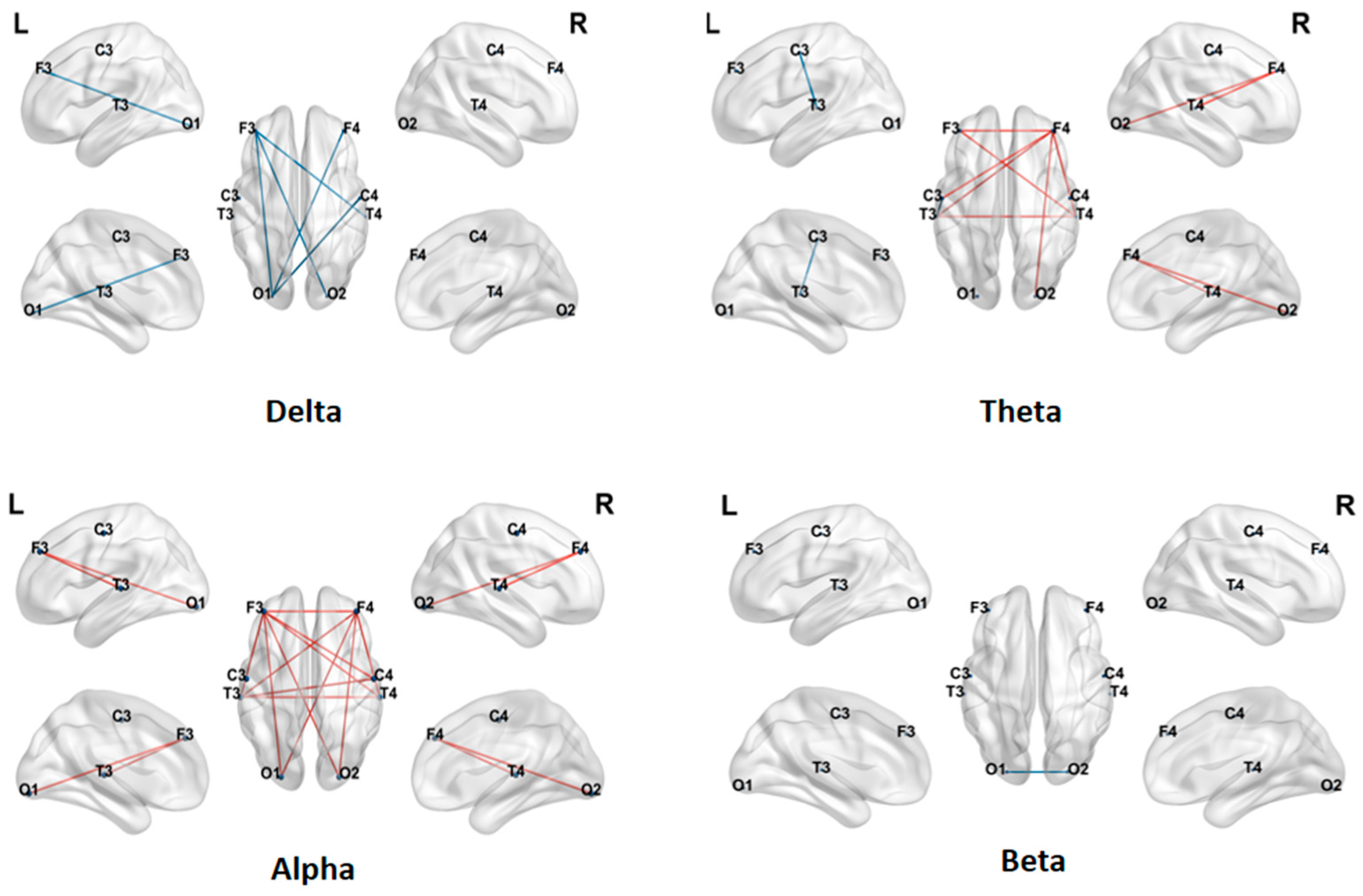 Brainsci 16 00091 g002 Brainsci 16 00091 g002