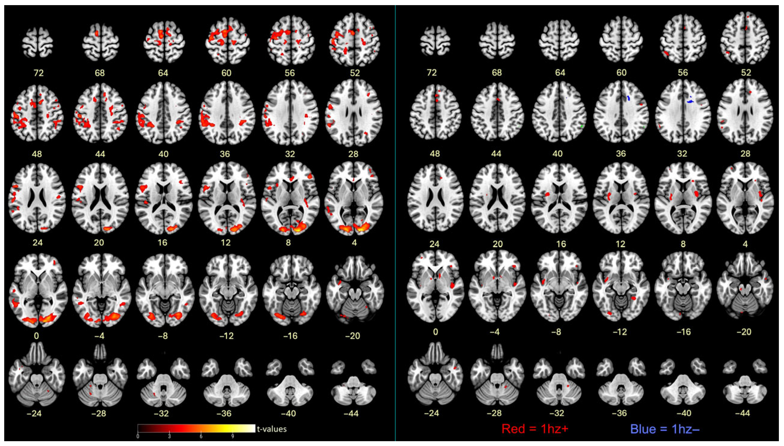 Brainsci 16 00120 g005