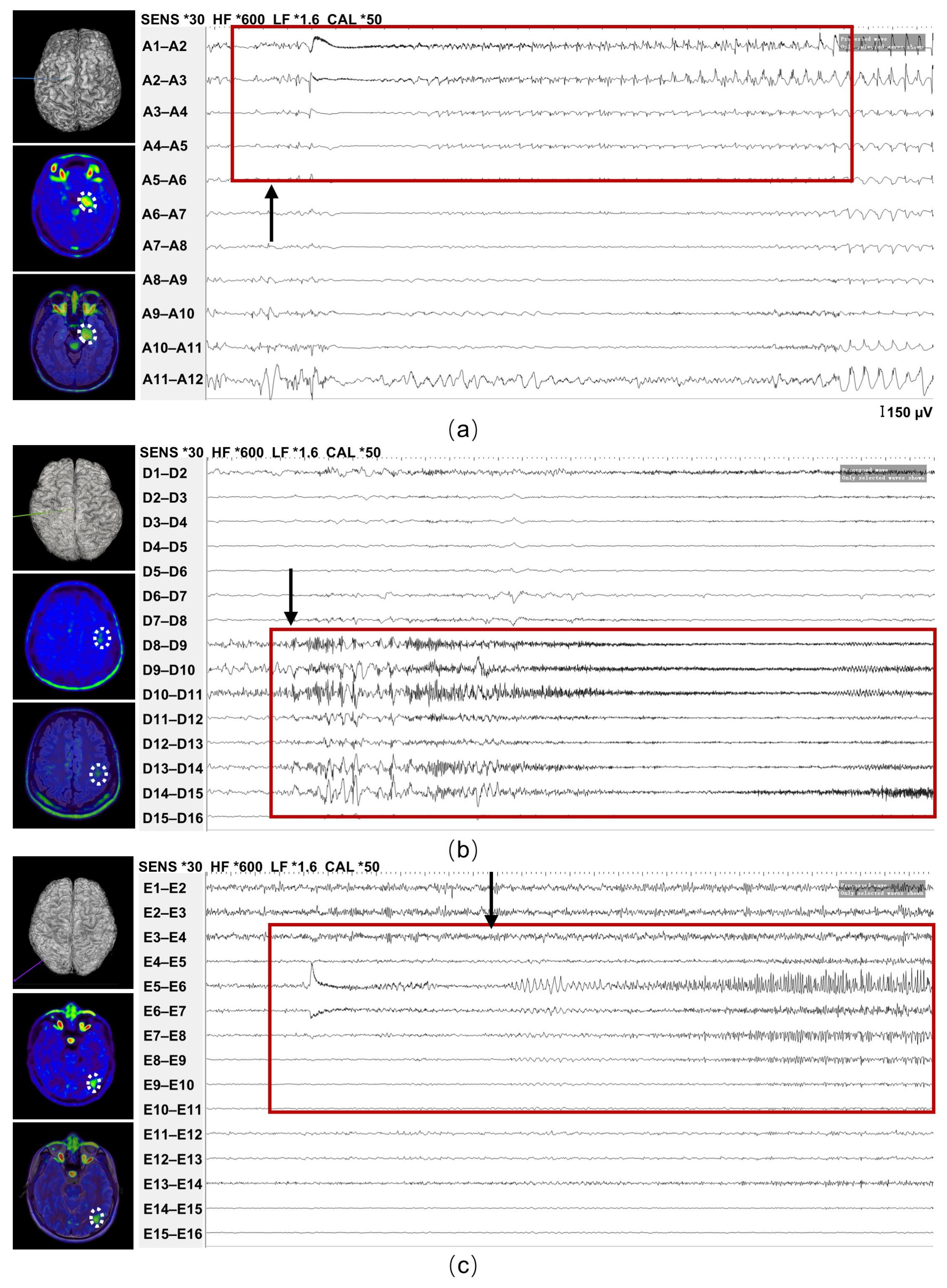 Brainsci 16 00246 g006 Brainsci 16 00246 g006