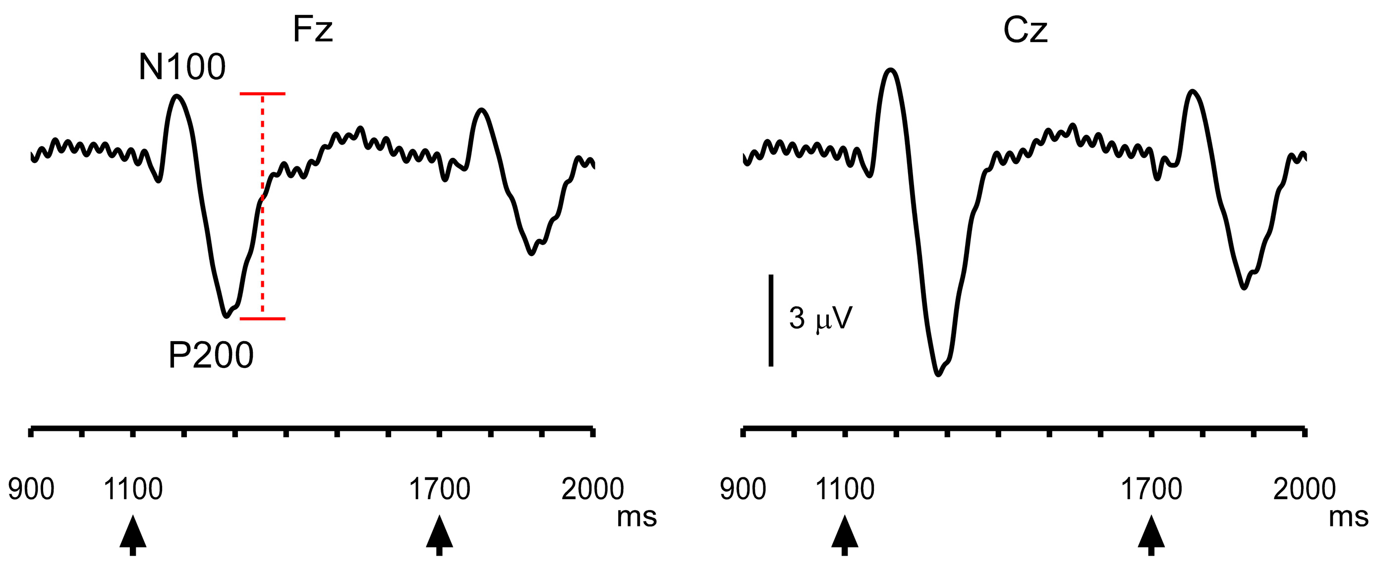 Brainsci 16 00247 g003 Brainsci 16 00247 g003