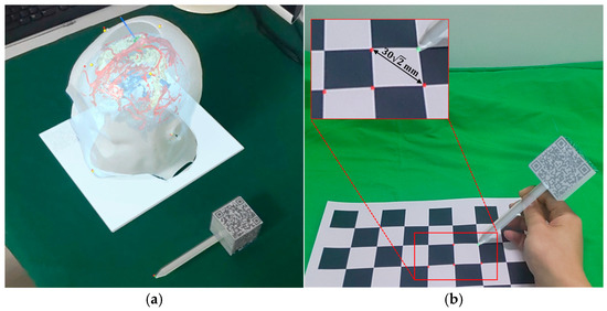 Spatial coordinate acquisition of reference points using Marker B: (a) Localization of anatomical landmarks on the phantom; (b) Localization of corner points from a high-precision checkerboard calibration board.