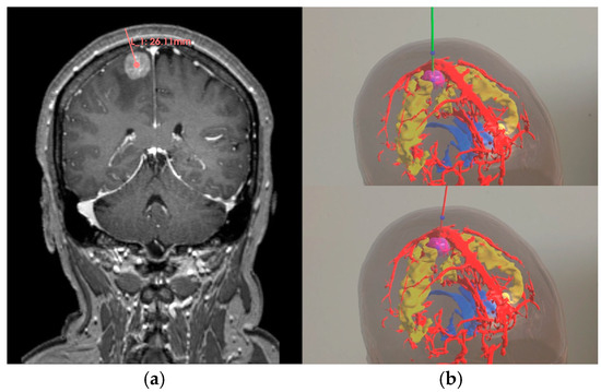Two manual path planning methods: (a) Manual path planning based on 2D images (in pink); (b) Interactive path planning using AR (safe mode in green and risk mode in red).
