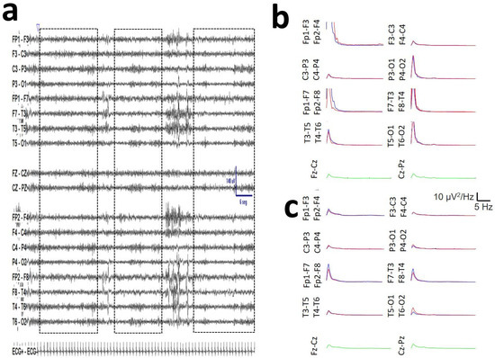 Brainsci 16 00328 g0a1