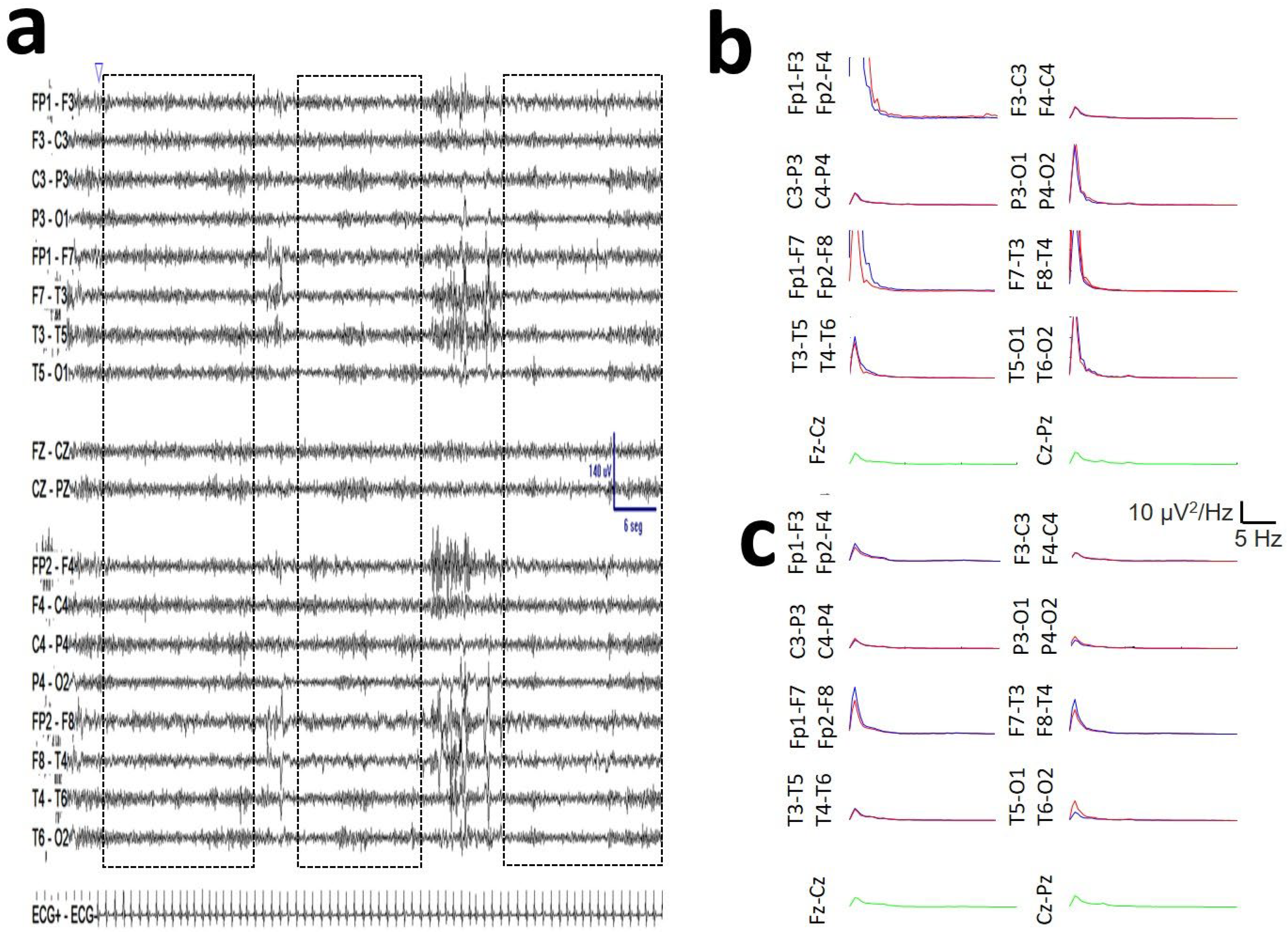 Brainsci 16 00328 g0a1