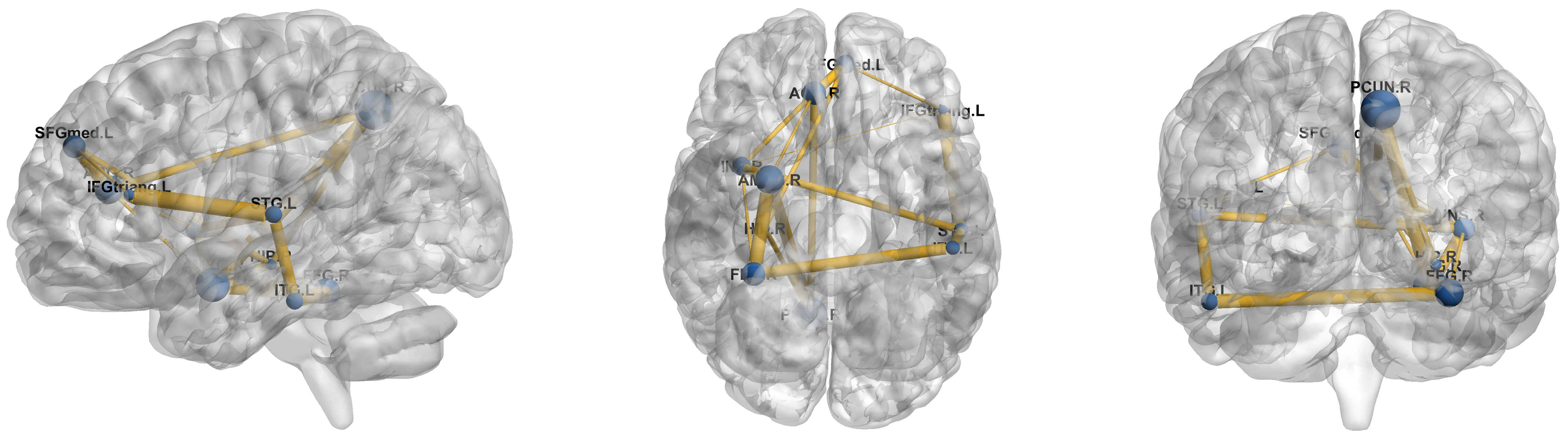 Brainsci 16 00378 g003 Brainsci 16 00378 g003