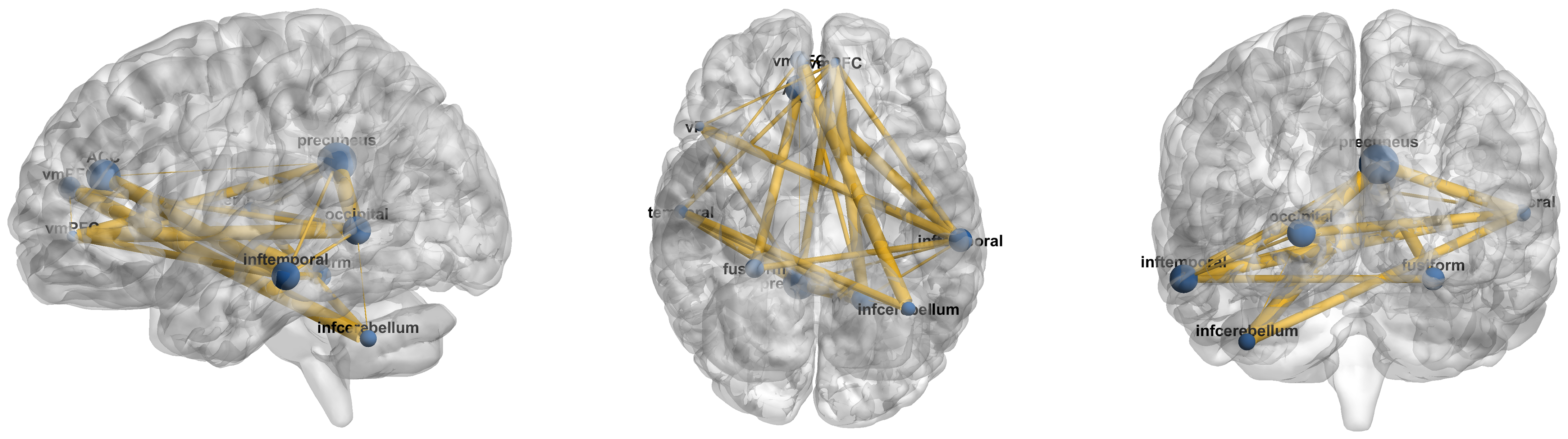 Brainsci 16 00378 g004 Brainsci 16 00378 g004