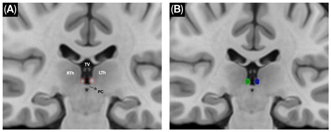 Brainsci 16 00490 g001 Brainsci 16 00490 g001