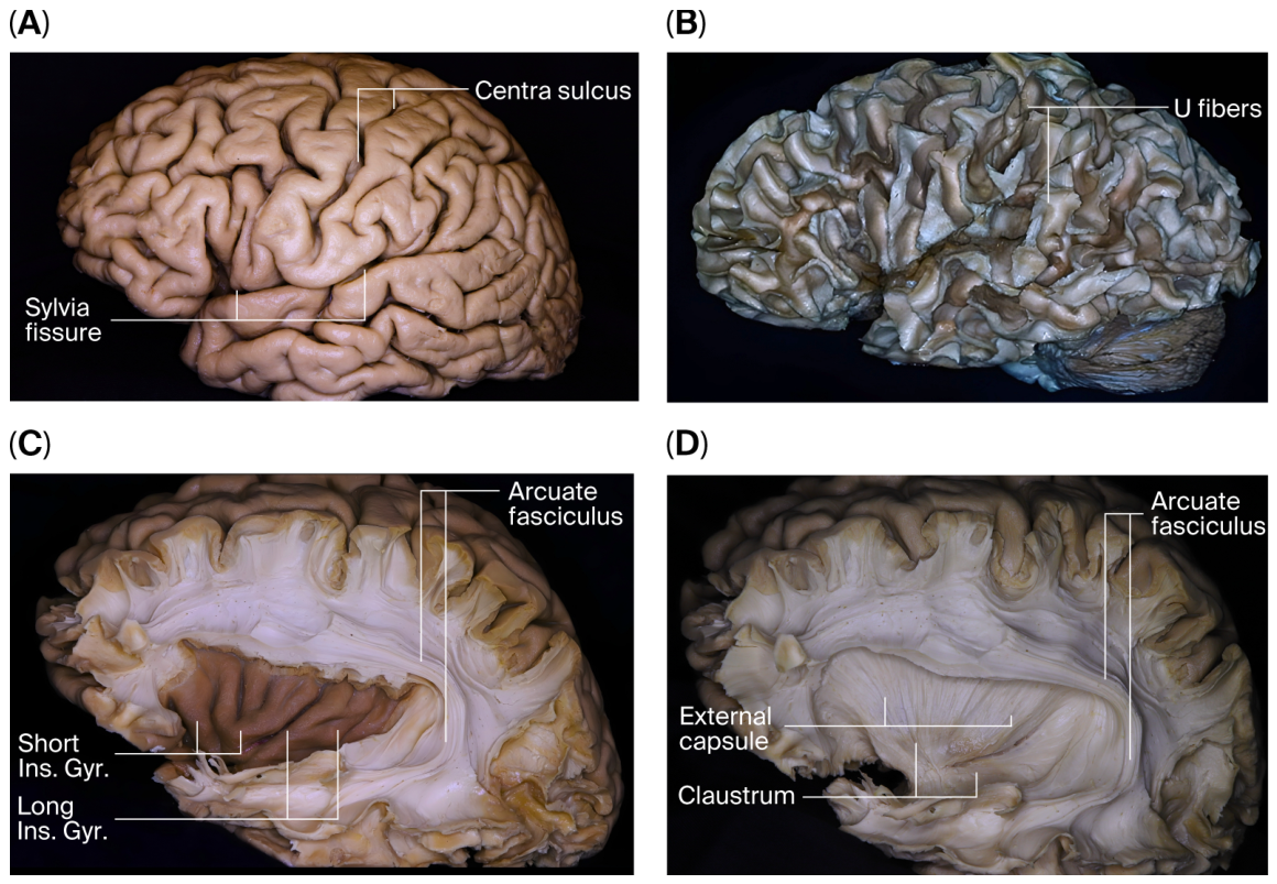 Brainsci 16 00490 g002 Brainsci 16 00490 g002