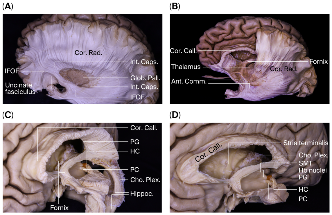 Brainsci 16 00490 g003 Brainsci 16 00490 g003