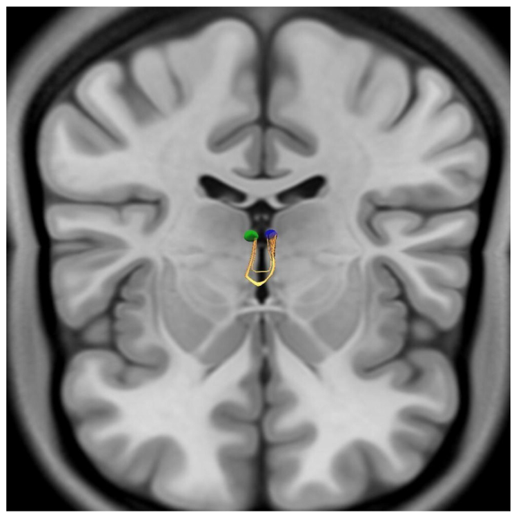Brainsci 16 00490 g004 Brainsci 16 00490 g004