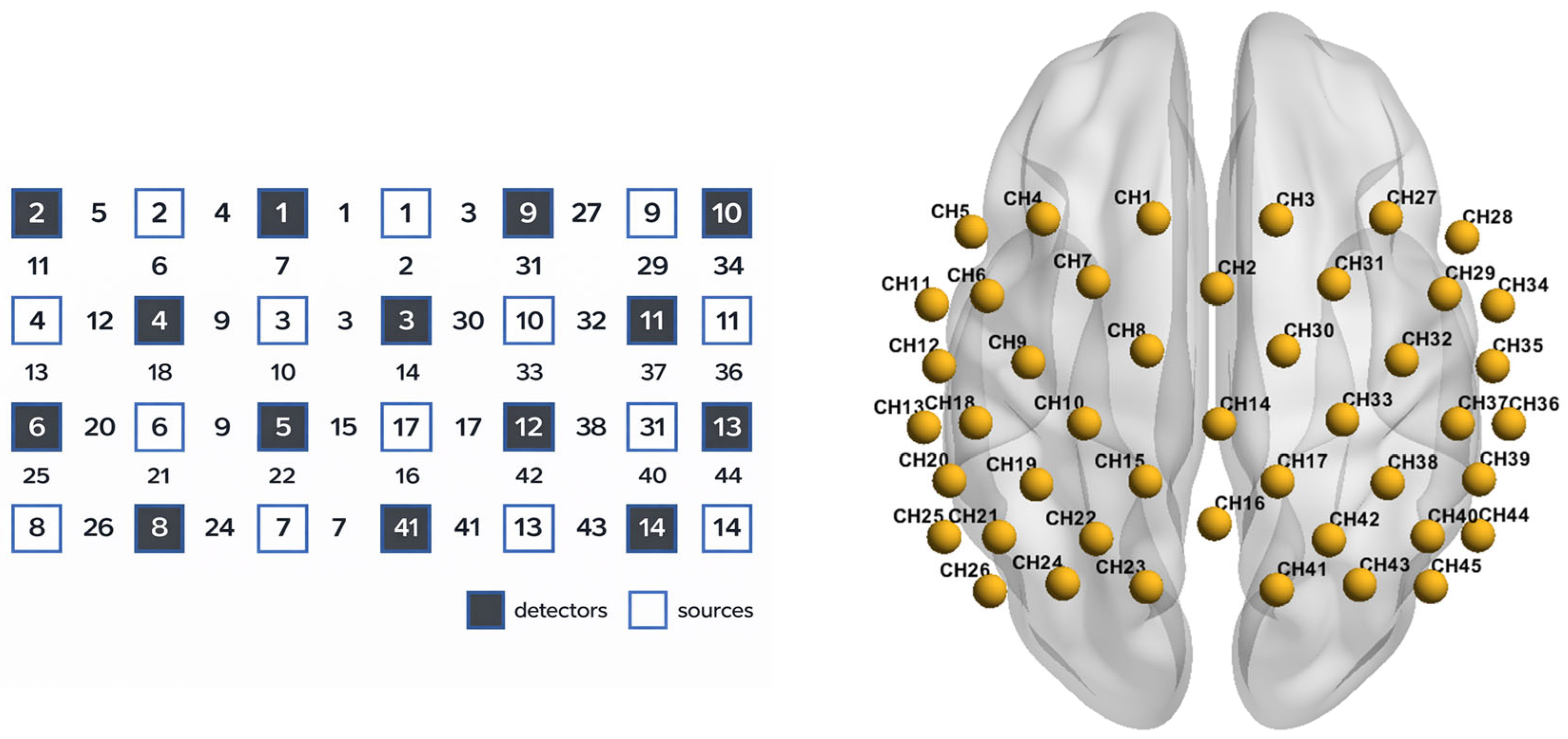 Brainsci 16 00629 g001 Brainsci 16 00629 g001