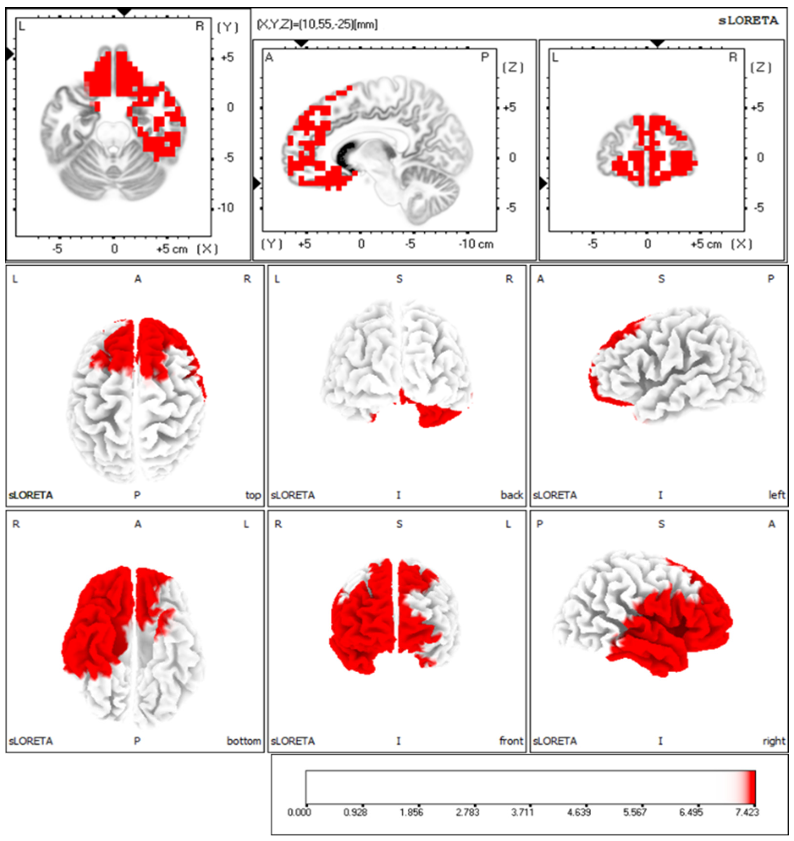 Brainsci 16 00642 g003