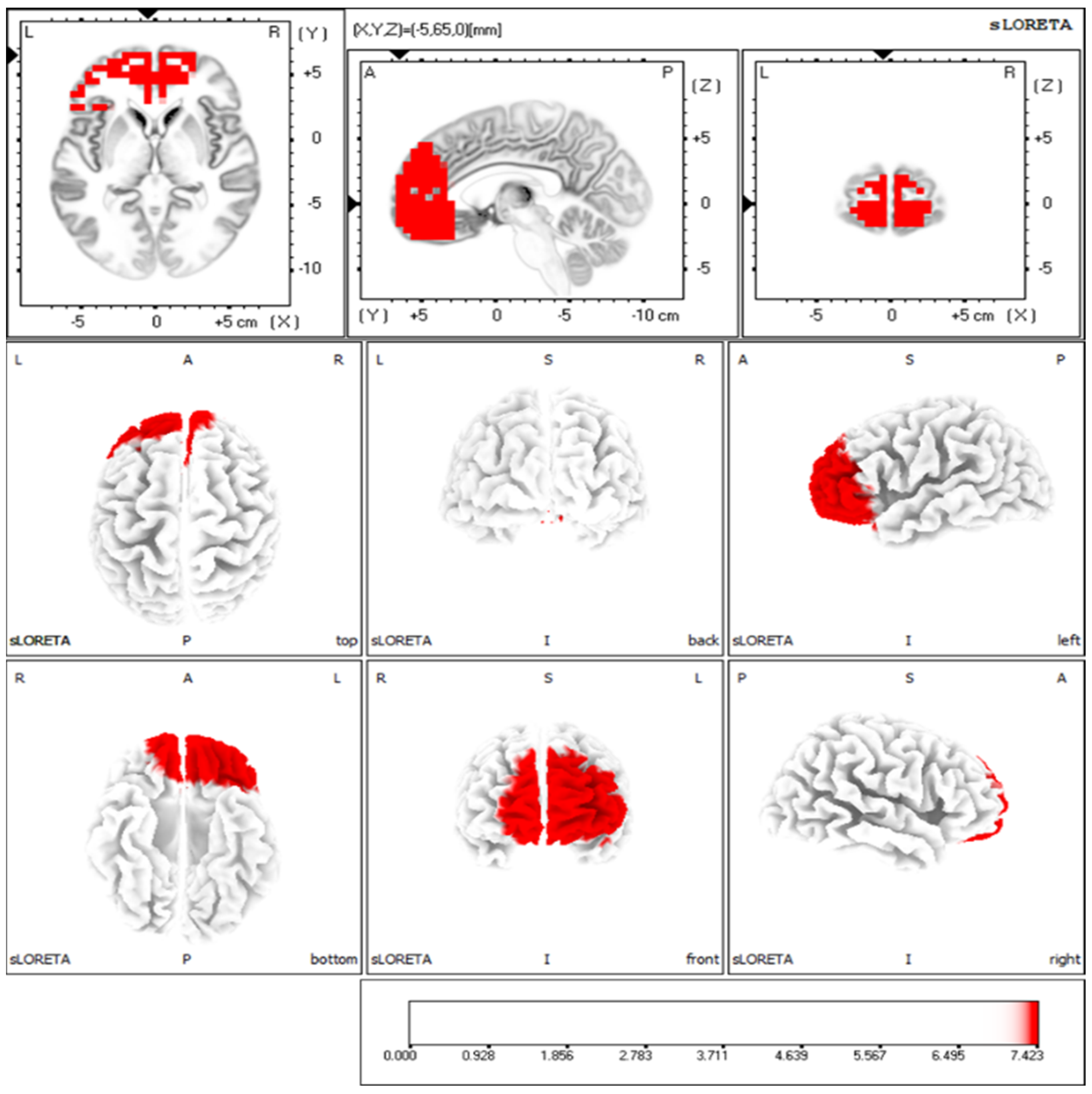 Brainsci 16 00642 g004