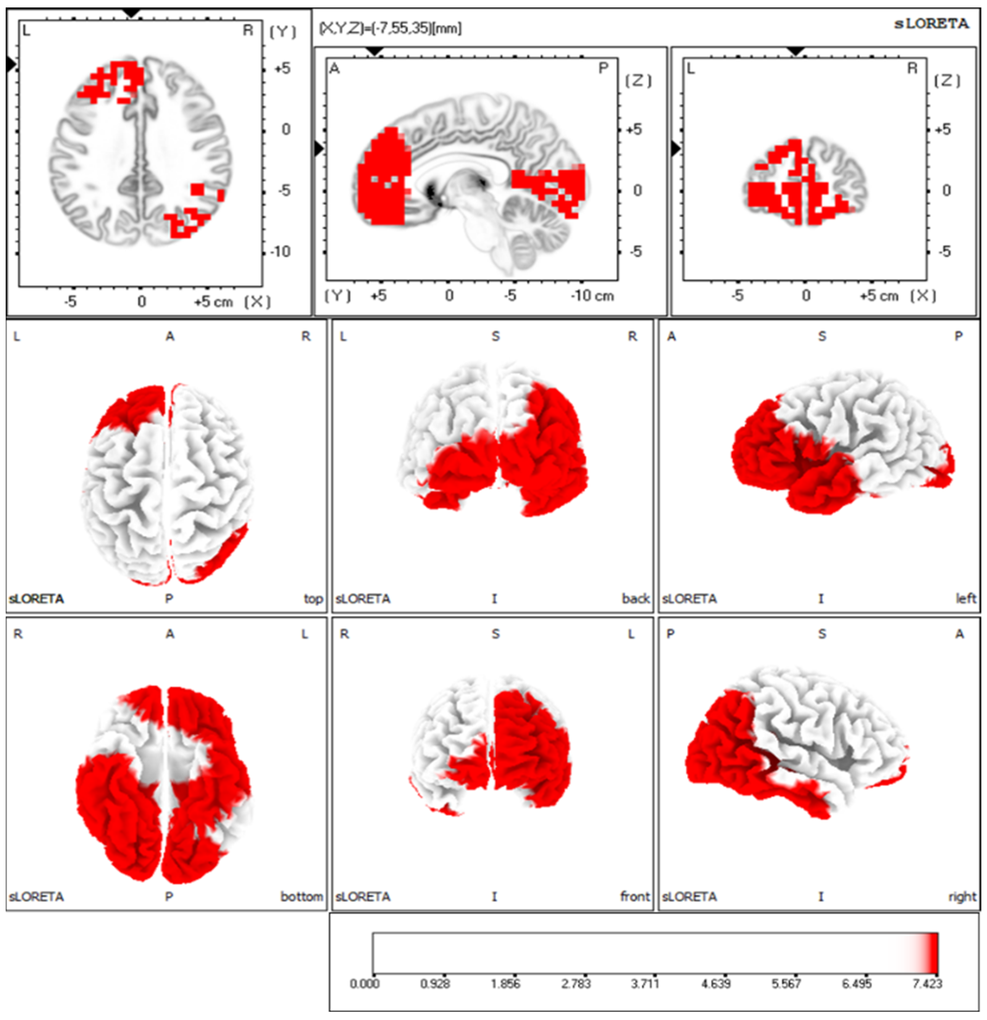 Brainsci 16 00642 g006