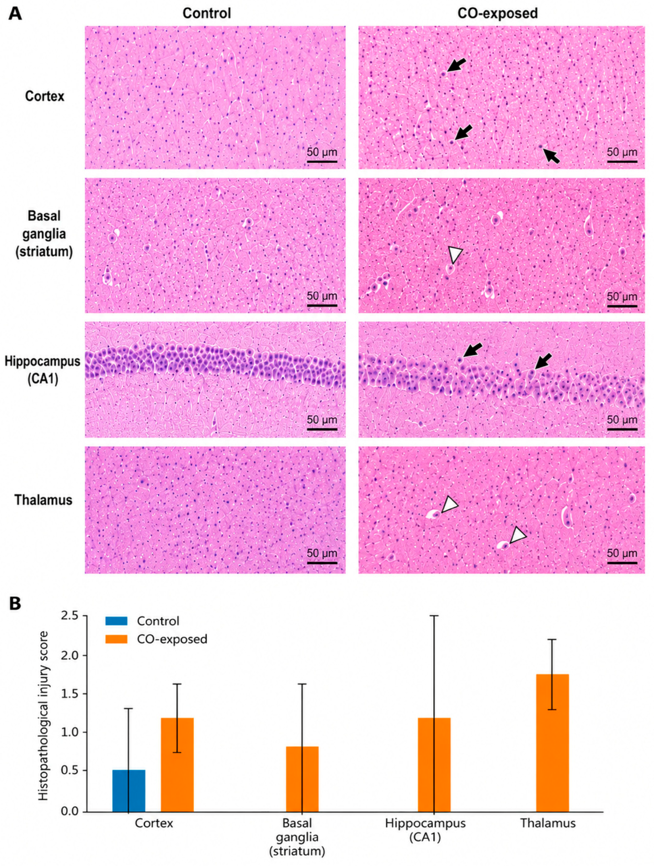Brainsci 16 00647 g003 Brainsci 16 00647 g003