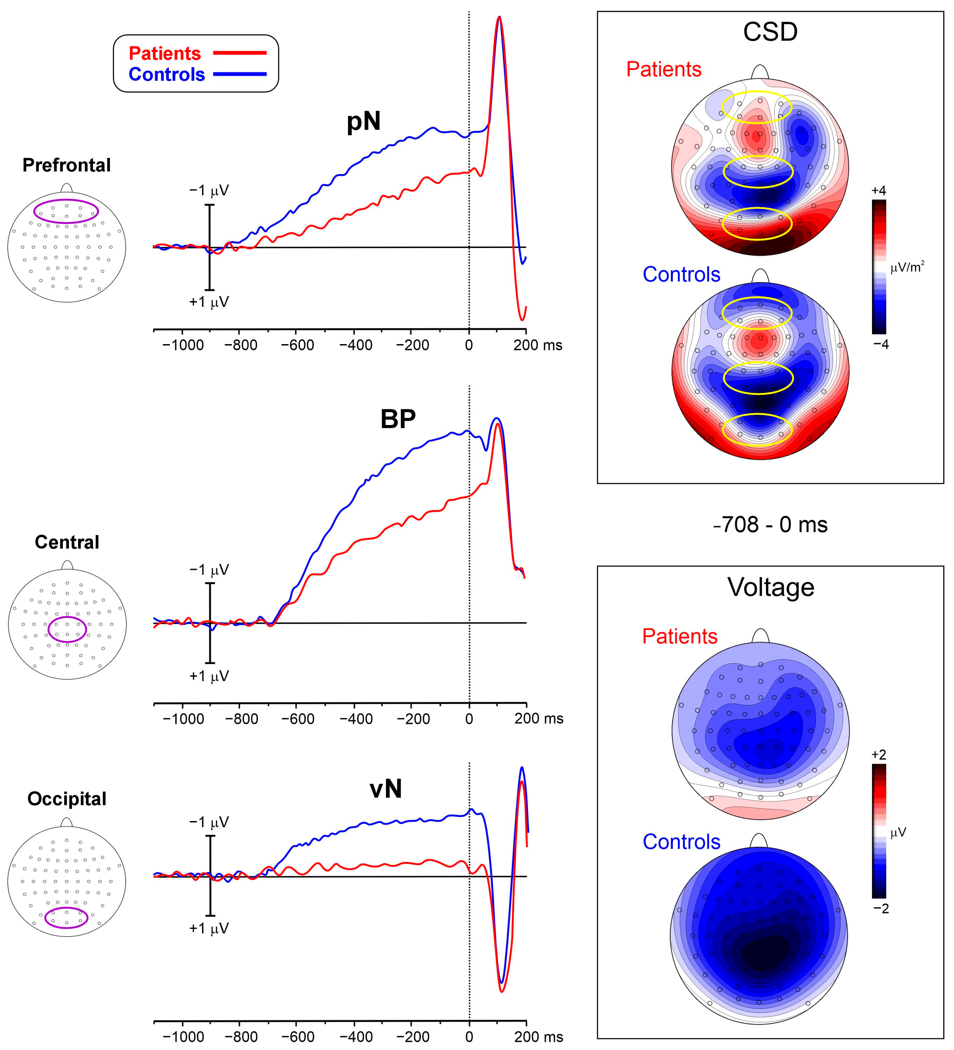 Brainsci 16 00810 g004 Brainsci 16 00810 g004
