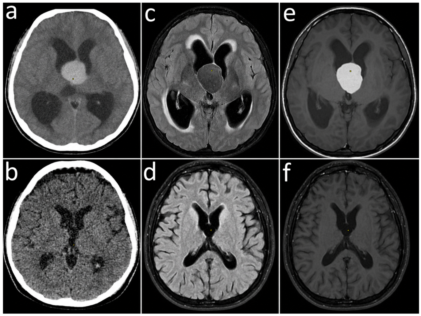Brainsci 16 01101 g001 Brainsci 16 01101 g001