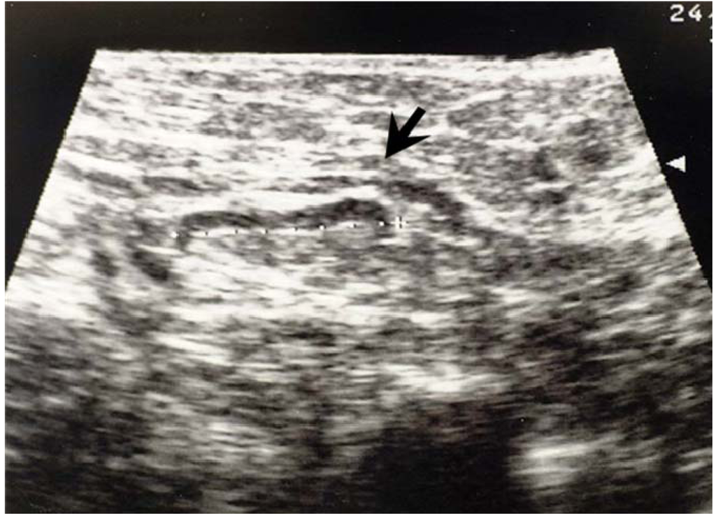 Cancers 02 00020 g004 1024