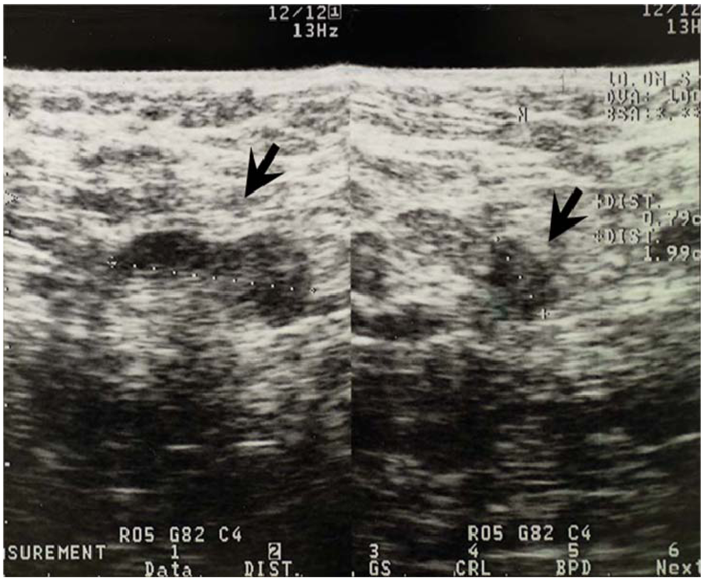 Cancers 02 00020 g005 1024