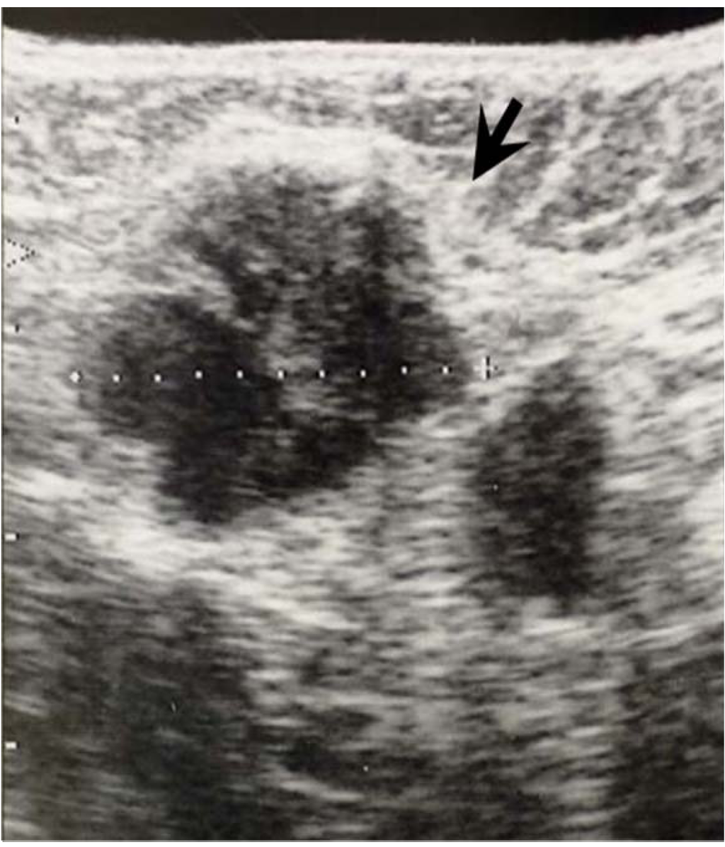 Cancers 02 00020 g006 1024