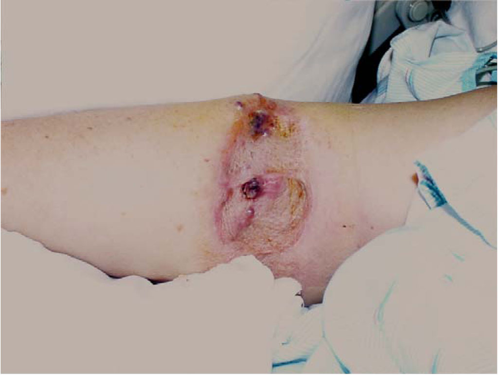 Cancers 02 00043 g001 1024