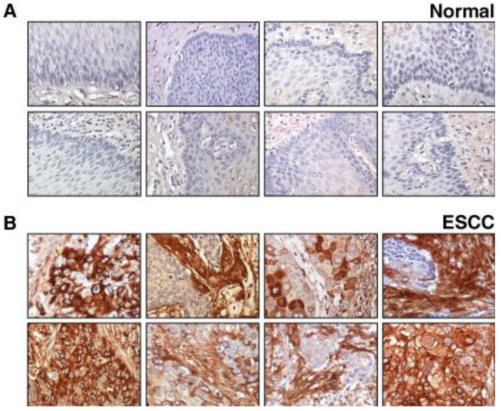 Cancers 02 00133 g003 1024