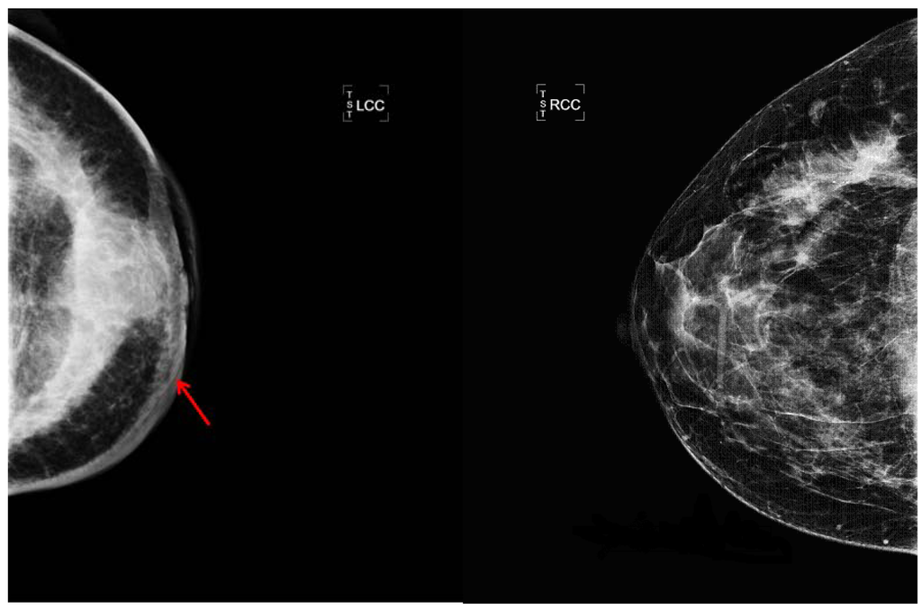 Cancers 02 00143 g002 1024