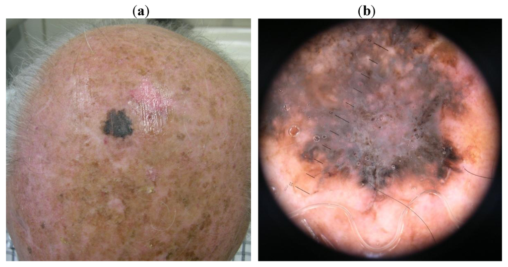 Cancers 02 01597 g003 1024