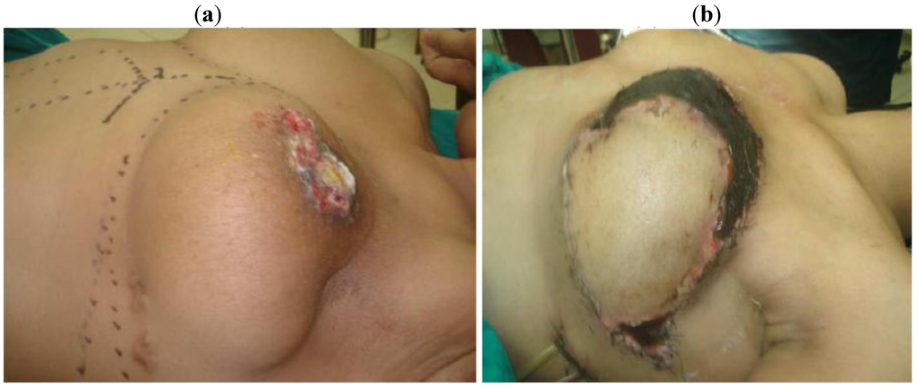 Cancers 02 01771 g001 1024