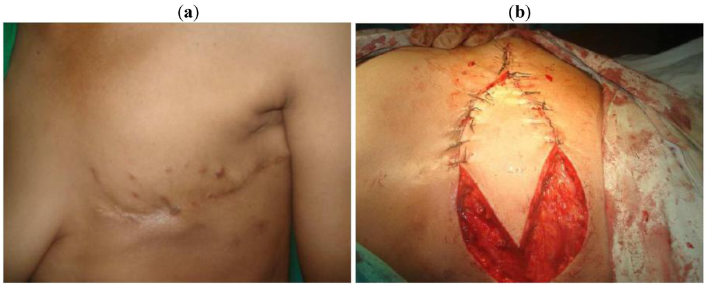 Cancers 02 01771 g002 1024