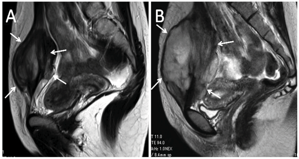 Cancers 04 00088 g002 1024