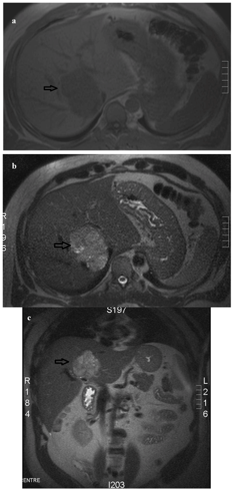 Cancers 04 00130 g001 1024
