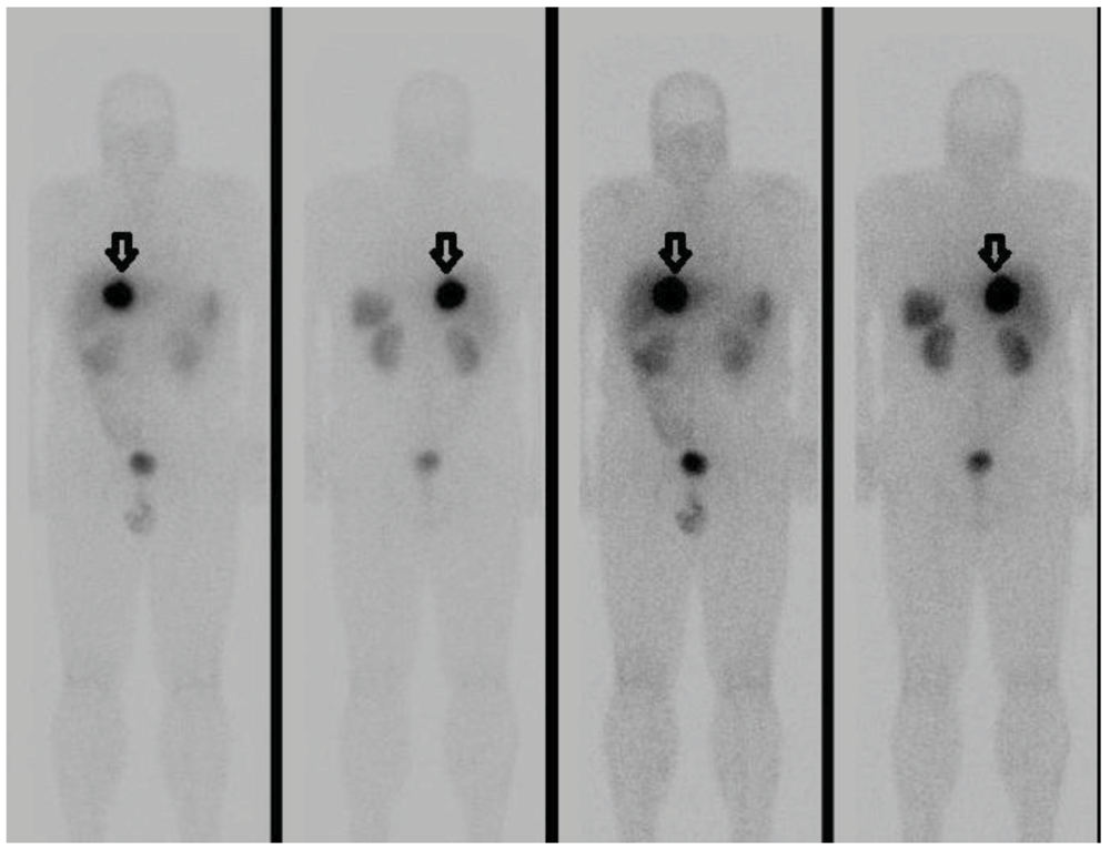 Cancers 04 00130 g002 1024