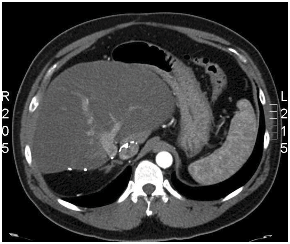 Cancers 04 00130 g003 1024