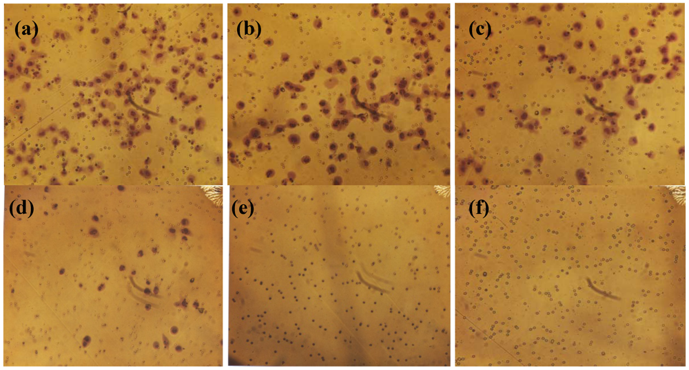 Cancers 04 00323 g005 1024