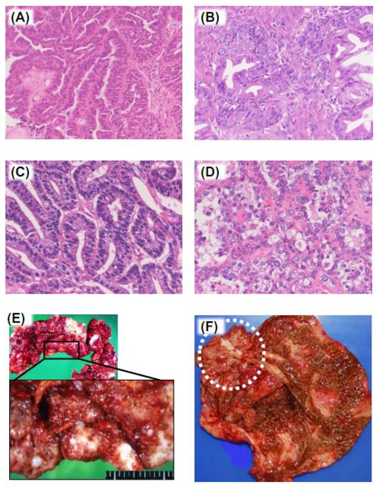 Cancers 04 00701 g002