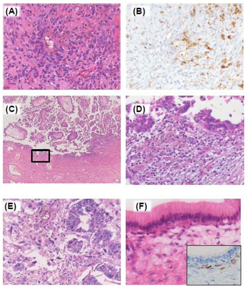 Cancers 04 00701 g003 1024