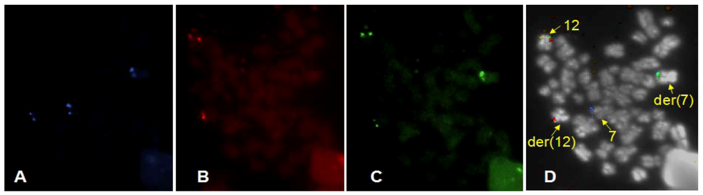 Cancers 05 00281 g005 1024