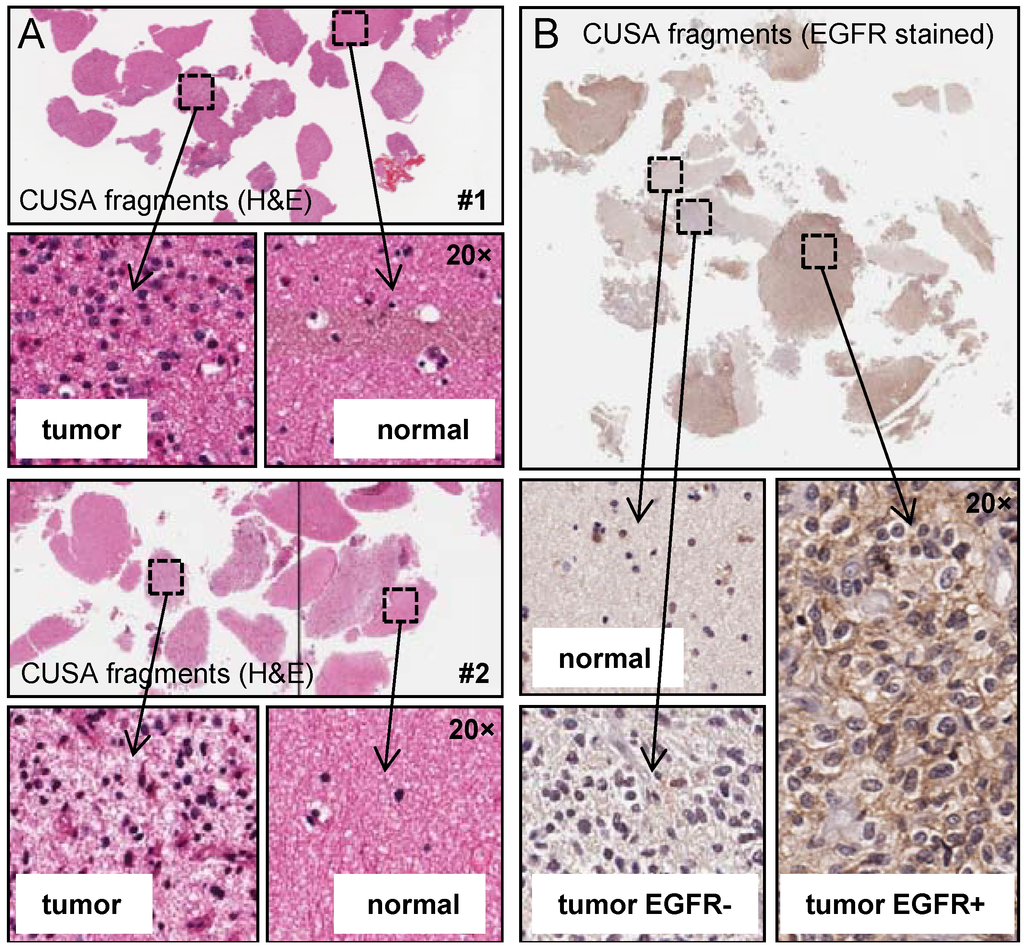 Cancers 05 00357 g002 1024
