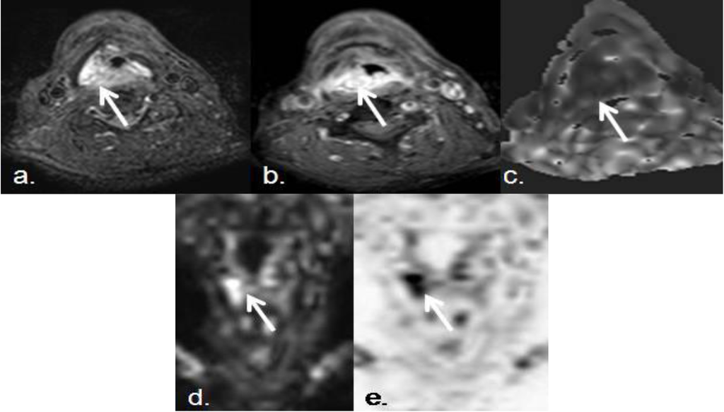 Cancers 05 00875 g005 1024