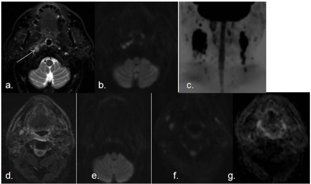 Cancers 05 00875 g006 1024