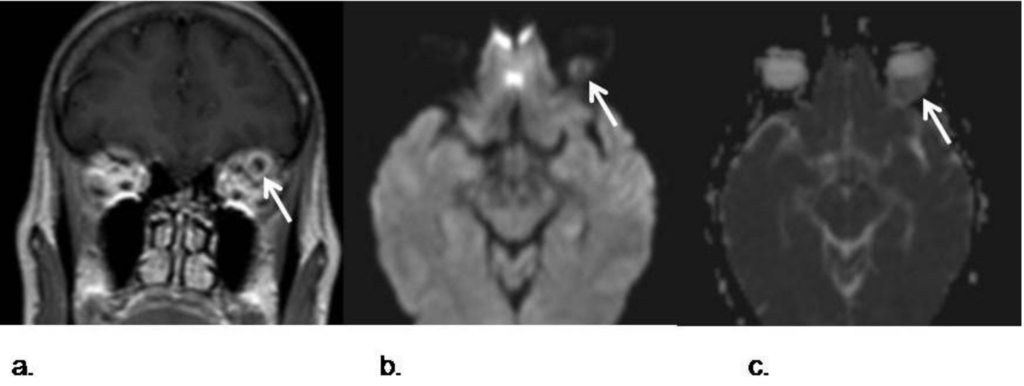 Cancers 05 00875 g008 1024