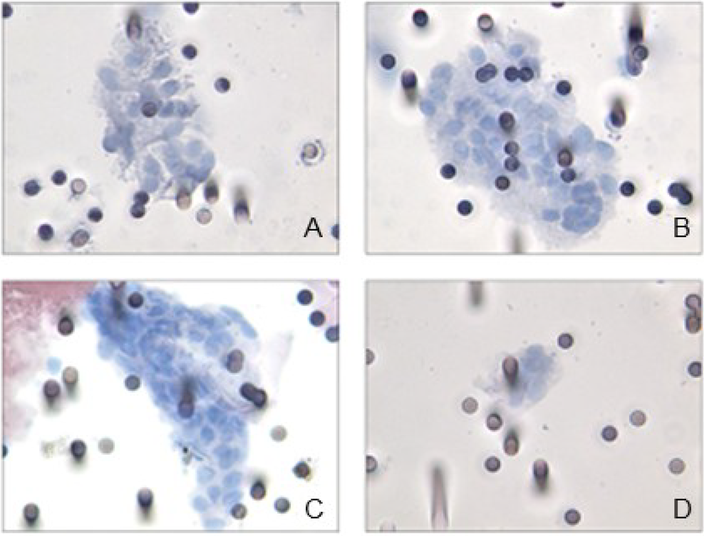 Cancers 06 00323 g001 1024